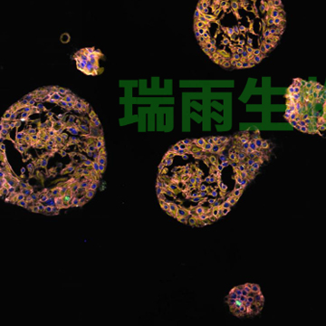 类器官病理鉴定